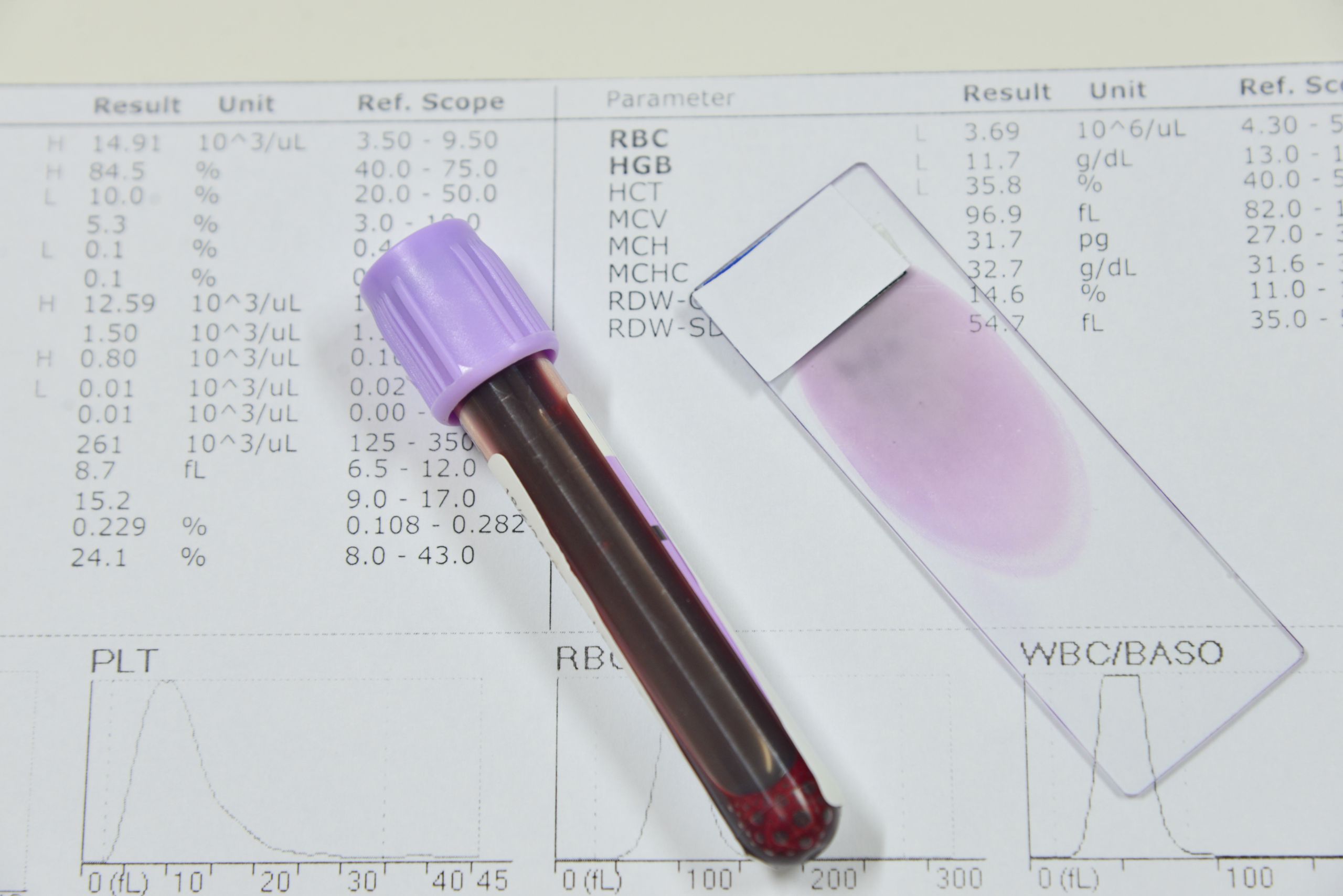 what-is-a-full-blood-count-test-goodbody-clinic