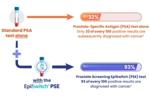 A diagram showing EpiSwitch PSE Prostate Cancer screening test benefits