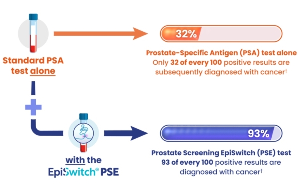 A diagram showing EpiSwitch PSE Prostate Cancer screening test benefits