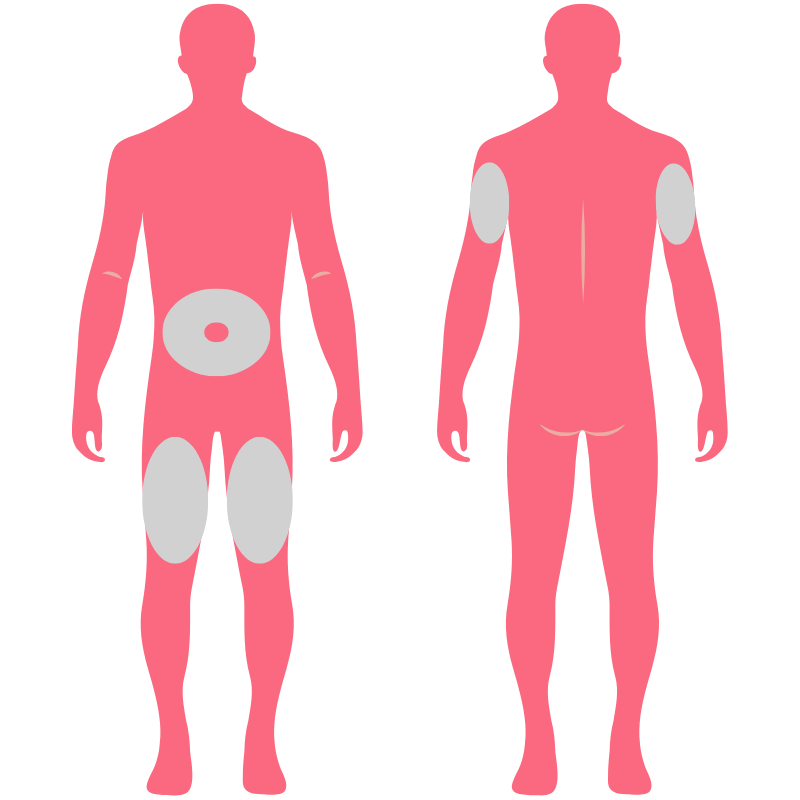 Weight loss injection sites shown on a pink silhouette icon