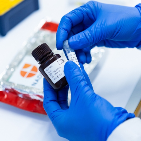 NAD Blood Test